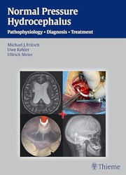 NPH Normal Pressure Hydrocephalus