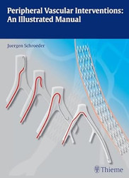 Peripheral Vascular Interventions