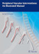 Peripheral Vascular Interventions