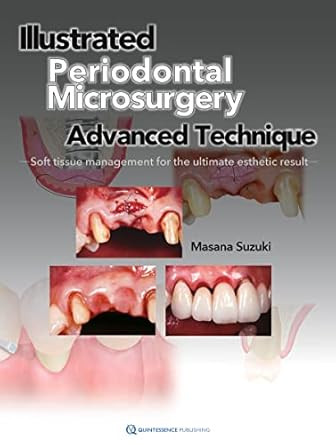 Illustrated Periodontal Microsurgery