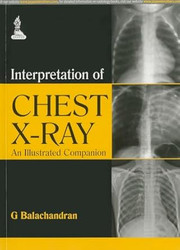 Interpretation of Chest X-Ray