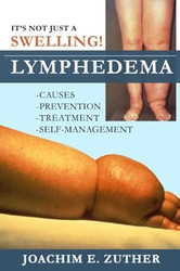 It's Not Just a Swelling! Lymphedema
