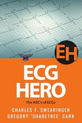 ECG Hero: The ABCs of ECGs