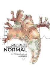 Manual de Electrocardiograma Normal