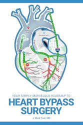 Your Simply Marvelous Roadmap to Heart Bypass Surgery