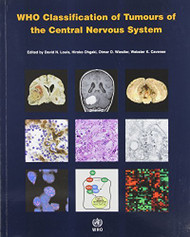 Who Classification Of Tumours Of Soft Tissue And Bone