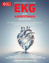 How to Correctly Answer EKG and Arrhythmia Questions