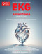 How to Correctly Answer EKG and Arrhythmia Questions