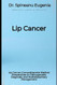 Lip Cancer