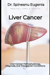 Liver Cancer