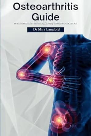 Osteoarthritis Guide