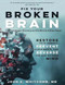 Fix Your Broken Brain