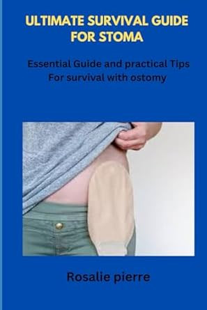 Ultimate Guide for Stoma
