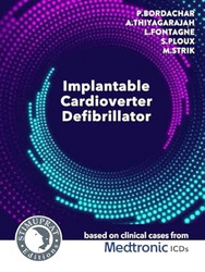 Implantable Cardioverter Defibrillator