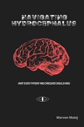 Navigating Hydrocephalus