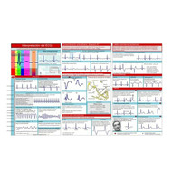 EKG Pocket Guide EKG Rhythm Interpretation Double Sided