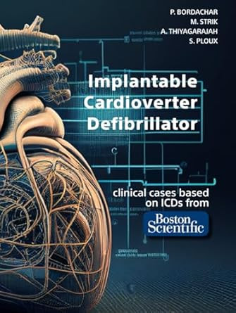 Implantable Cardioverter Defibrillator