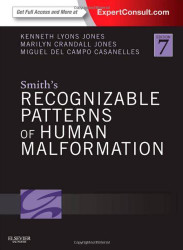 Smith's Recognizable Patterns Of Human Malformation