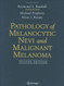 Pathology Of Melanocytic Nevi And Malignant Melanoma