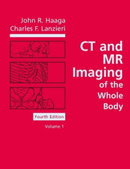 Ct And Mri Of The Whole Body 2 Volume set