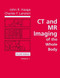 Ct And Mri Of The Whole Body 2 Volume set