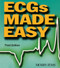 Ecgs Made Easy