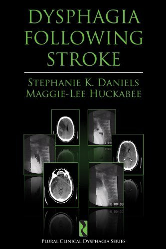 Dysphagia Following Stroke