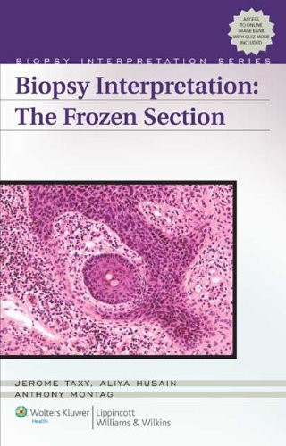 Biopsy Interpretation