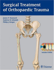 Surgical Treatment Of Orthopaedic Trauma