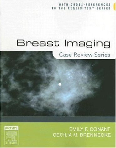 Breast Imaging