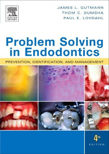 Problem Solving In Endodontics