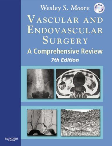 Vascular And Endovascular Surgery