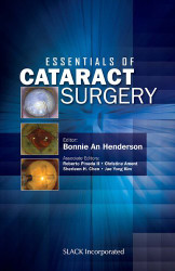 Essentials Of Cataract Surgery