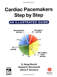 Cardiac Pacemakers Step-By-Step