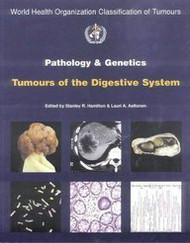 Who Classification Of Tumours Of The Digestive System