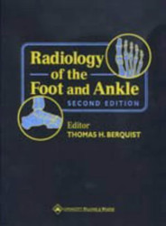 Radiology Of The Foot And Ankle