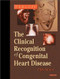 Clinical Recognition Of Congenital Heart Disease