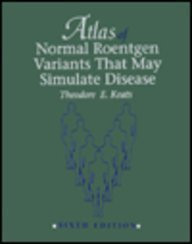 Atlas Of Normal Roentgen Variants That May Simulate Disease