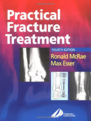 Practical Fracture Treatment