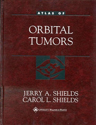 Eyelid Conjunctival And Orbital Tumors An Atlas And Textbook