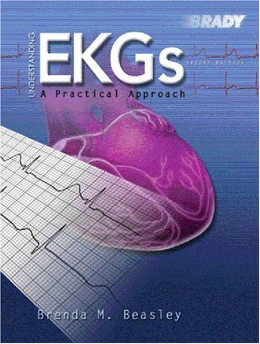 Understanding Ekgs