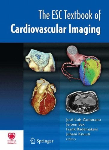 Esc Textbook Of Cardiovascular Imaging