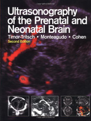 Ultrasonography Of The Prenatal And Neonatal Brain