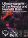 Ultrasonography Of The Prenatal And Neonatal Brain