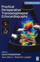 Practical Perioperative Transoesophageal Echocardiography