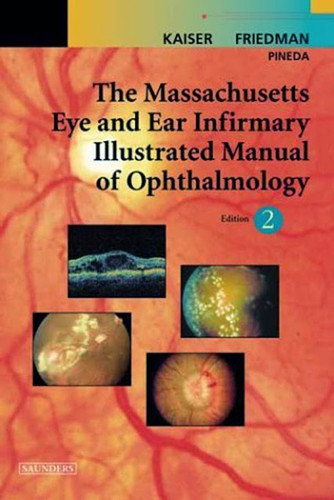 Massachusetts Eye And Ear Infirmary Illustrated Manual Of Ophthalmology