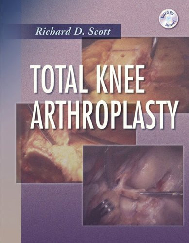 Total Knee Arthroplasty