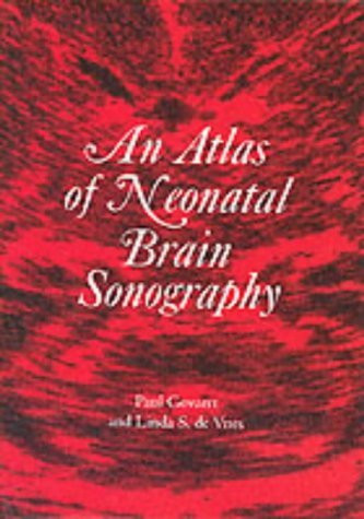 Atlas Of Neonatal Brain Sonography