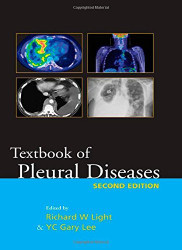 Textbook Of Pleural Diseases