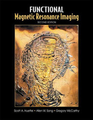 Functional Magnetic Resonance Imaging